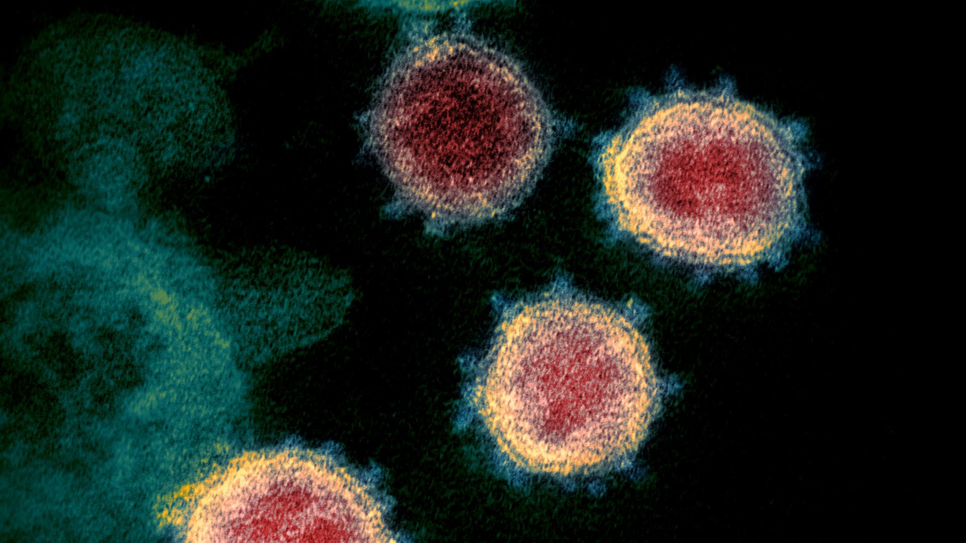 ‘Priority pathogens’ that pose greatest risk to public health revealed