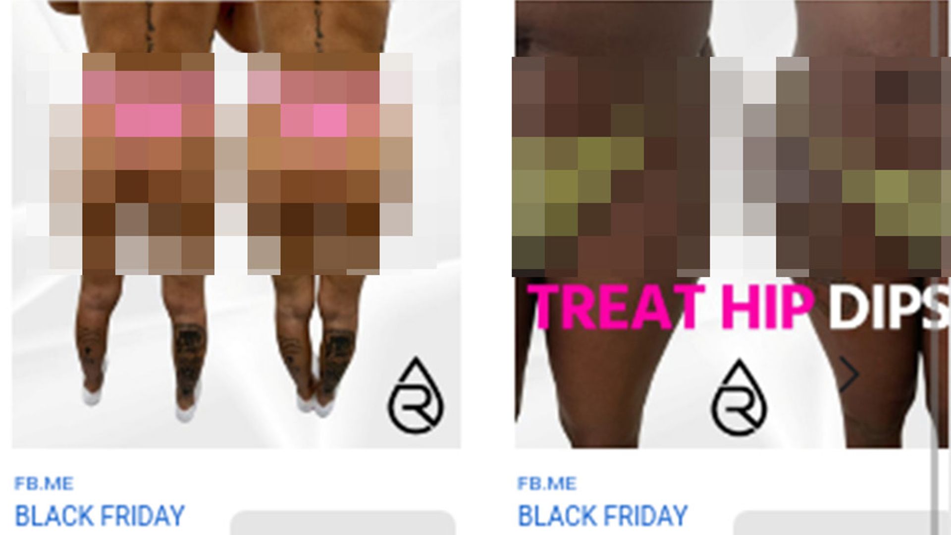 Brazilian butt lift adverts banned in the UK – here’s why