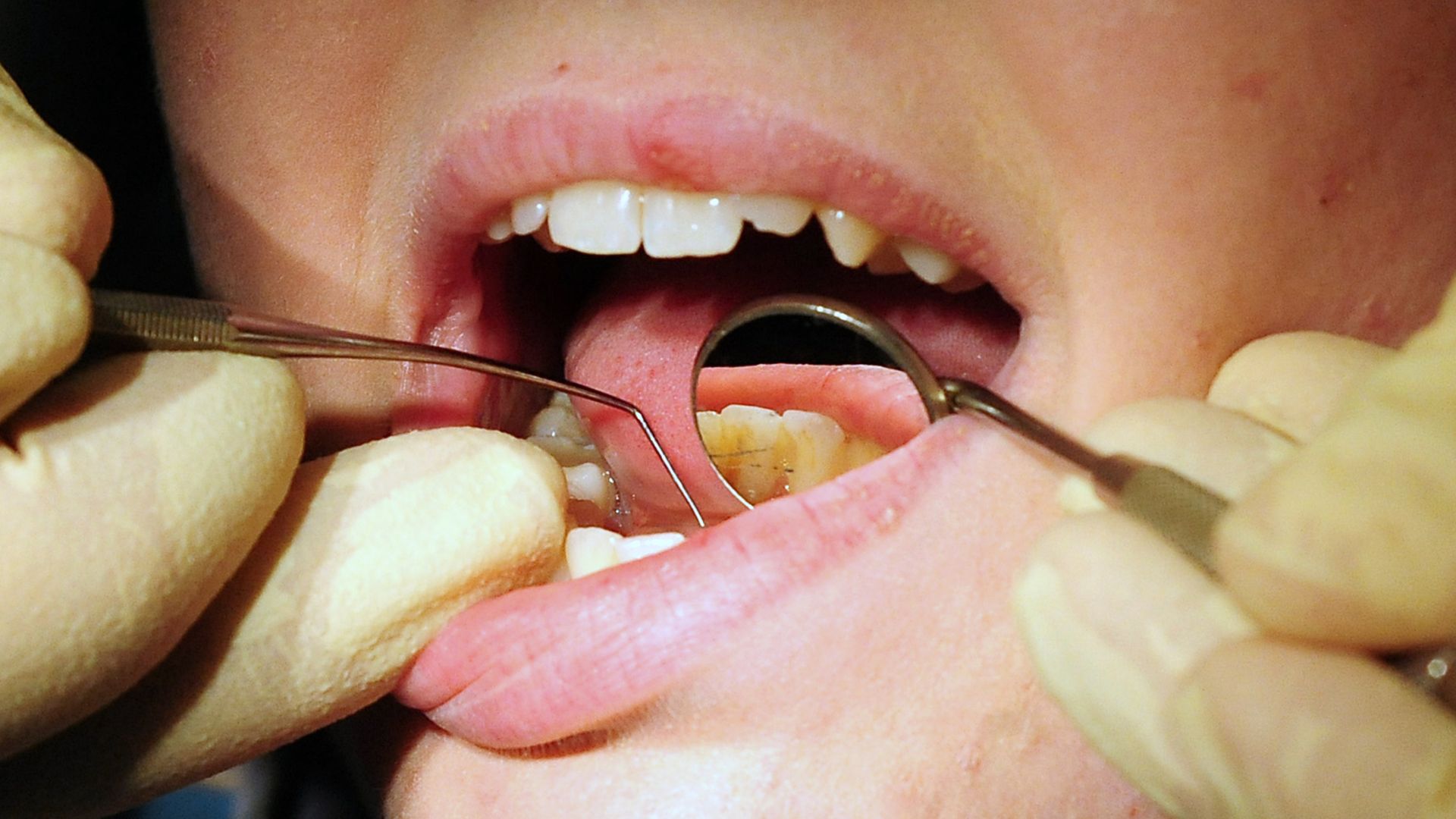 Scheme to boost access to NHS dentists has made things worse, MPs say