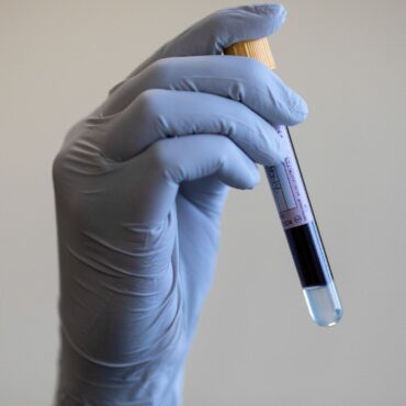 Blood test that can detect 12 common cancers to be trialled on NHS