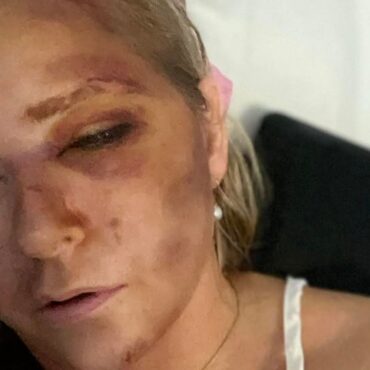 Prince Andrew accuser leaves hospital after saying she had ‘four days to live’
