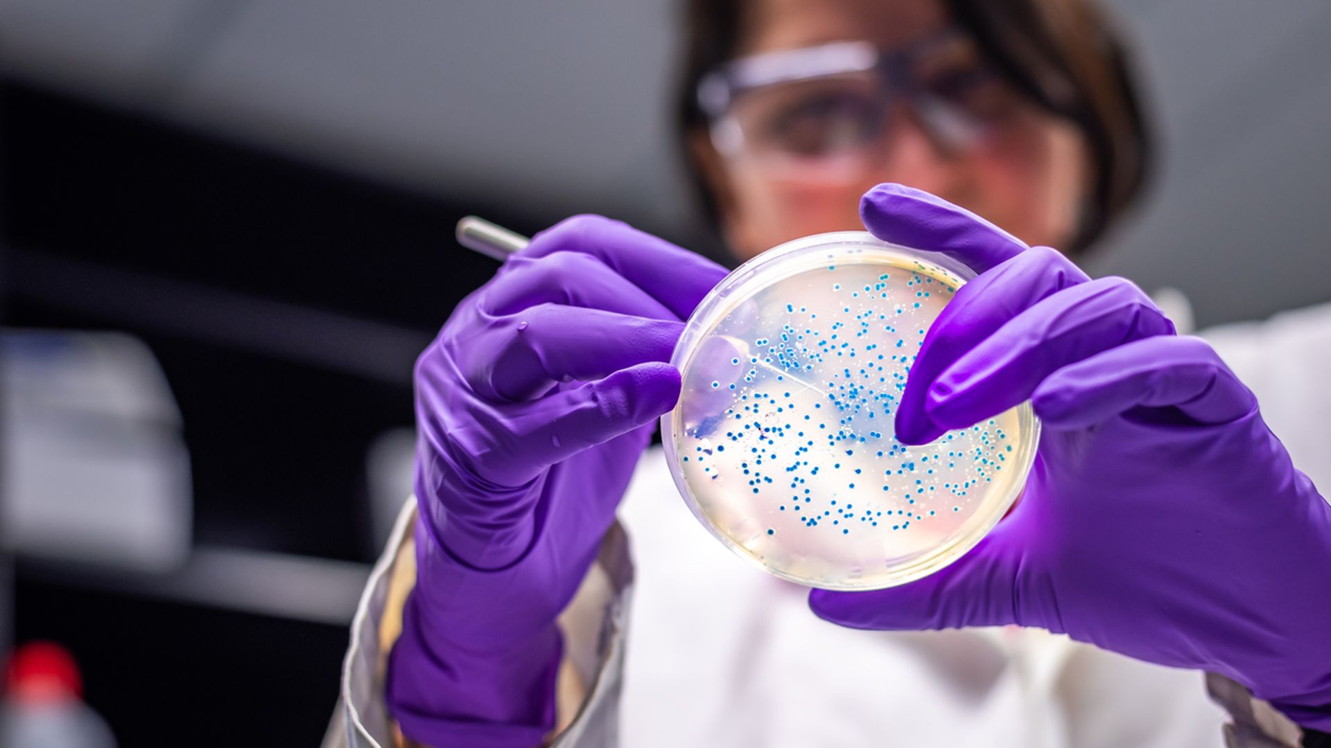 E.coli infections rise by 26% – as source of outbreaks and most vulnerable age groups revealed