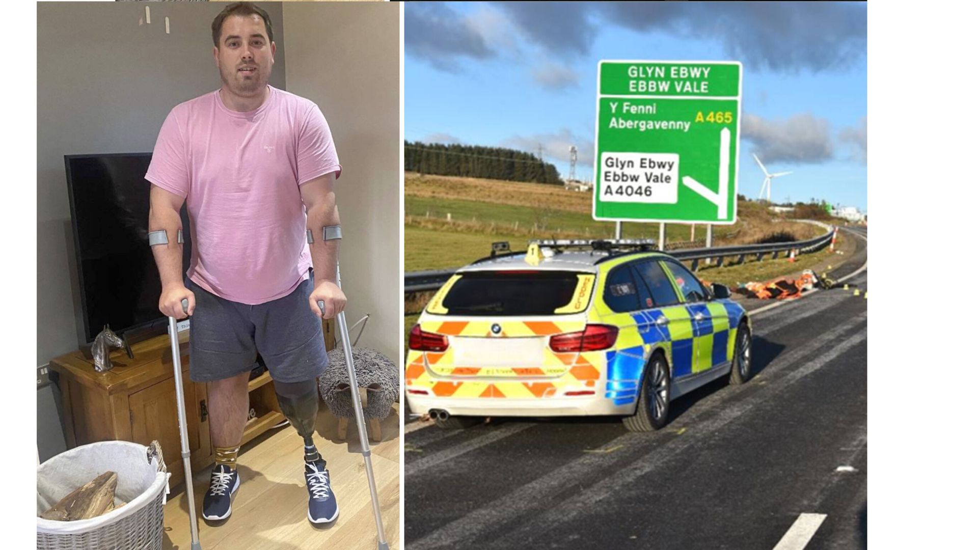 Man who had leg amputated after hit-and-run describes ‘agony’ of ‘phantom pain’