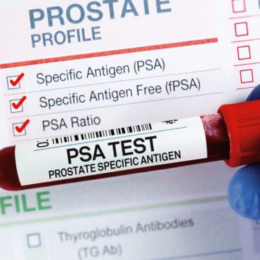 NHS screening programme for prostate cancer could come one step closer today
