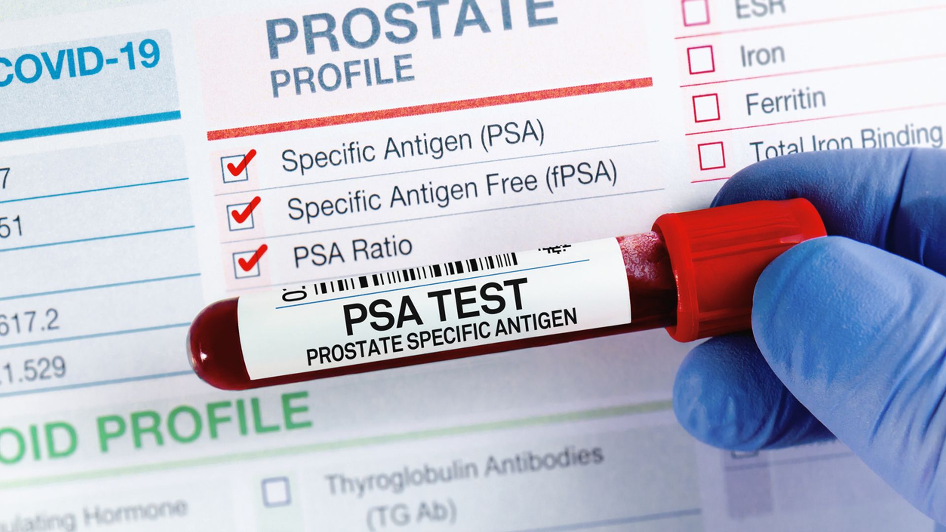 NHS screening programme for prostate cancer could come one step closer today