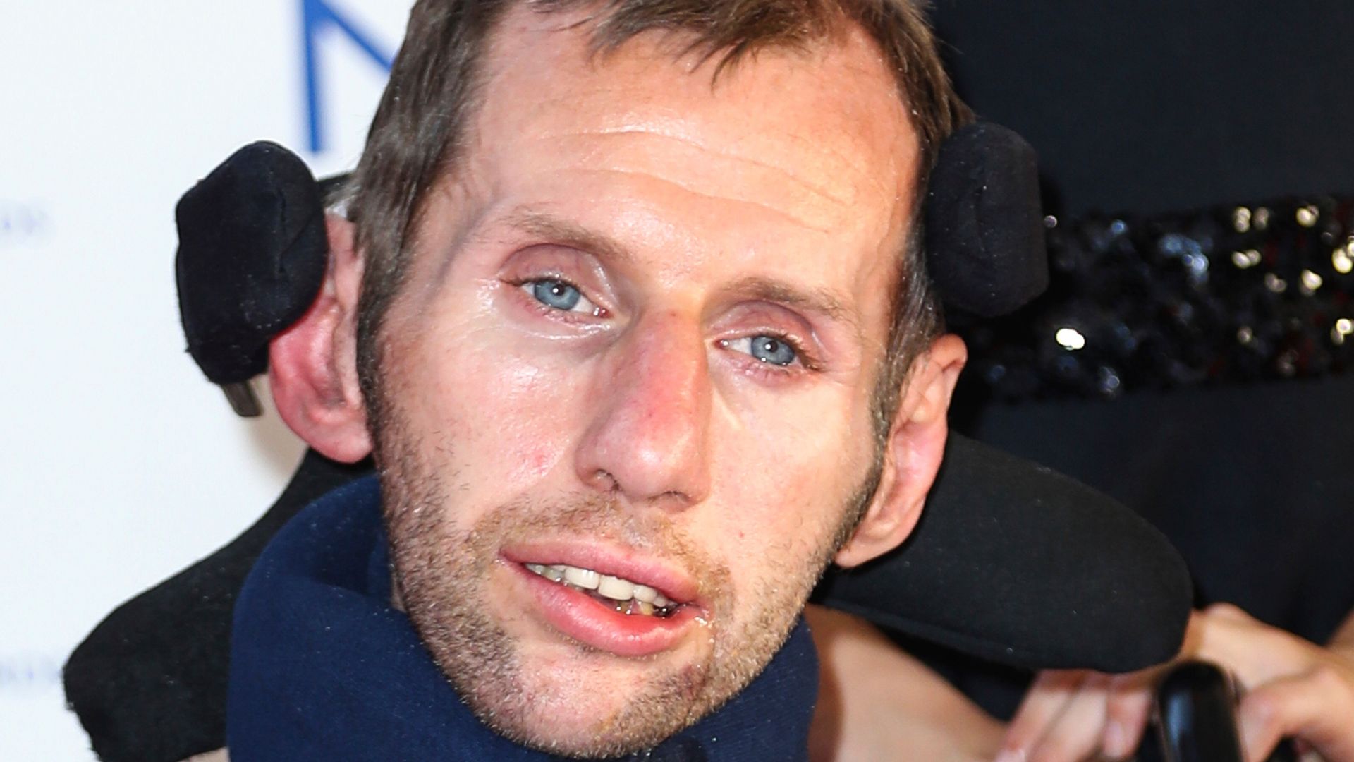 Drug breakthrough could ‘substantially slow progression’ of motor neurone disease
