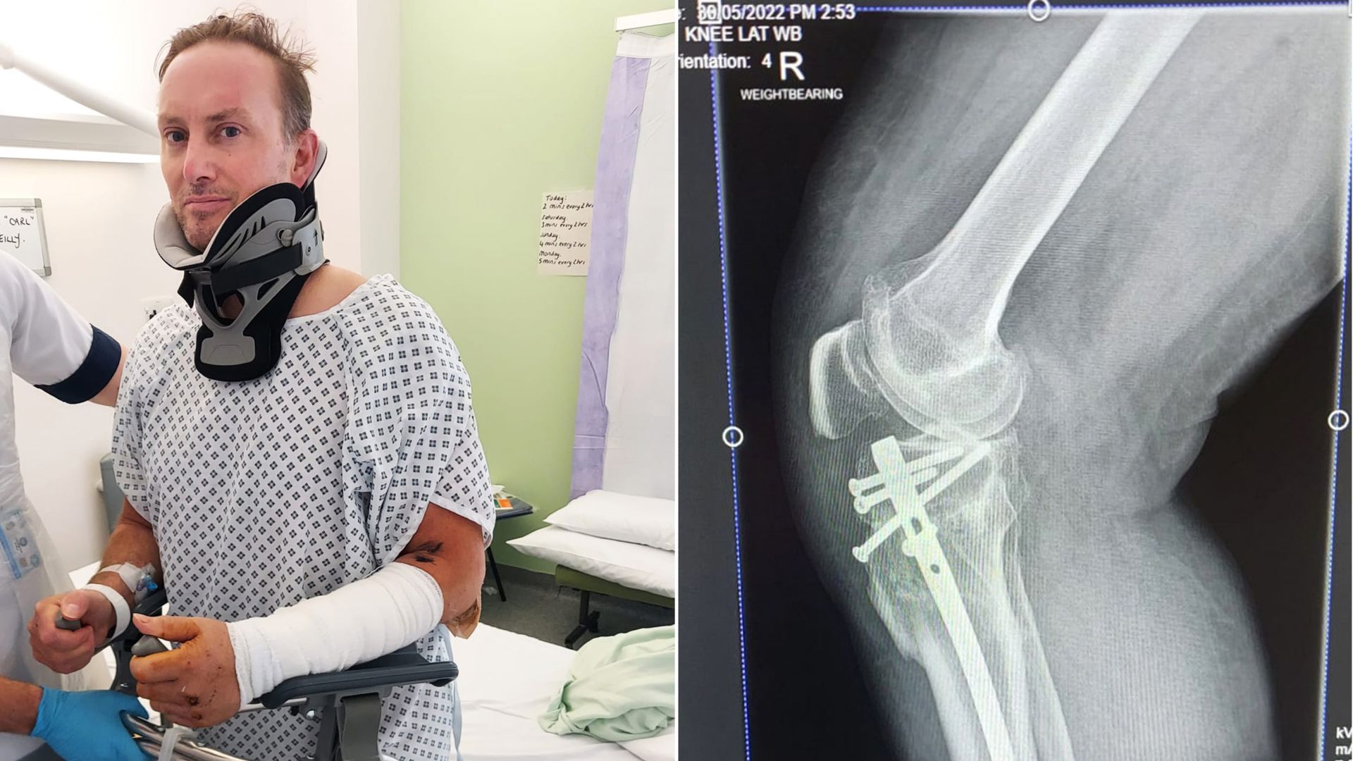 Worst areas for uninsured driving revealed – as hit-and-run victim says he was ‘left for dead’
