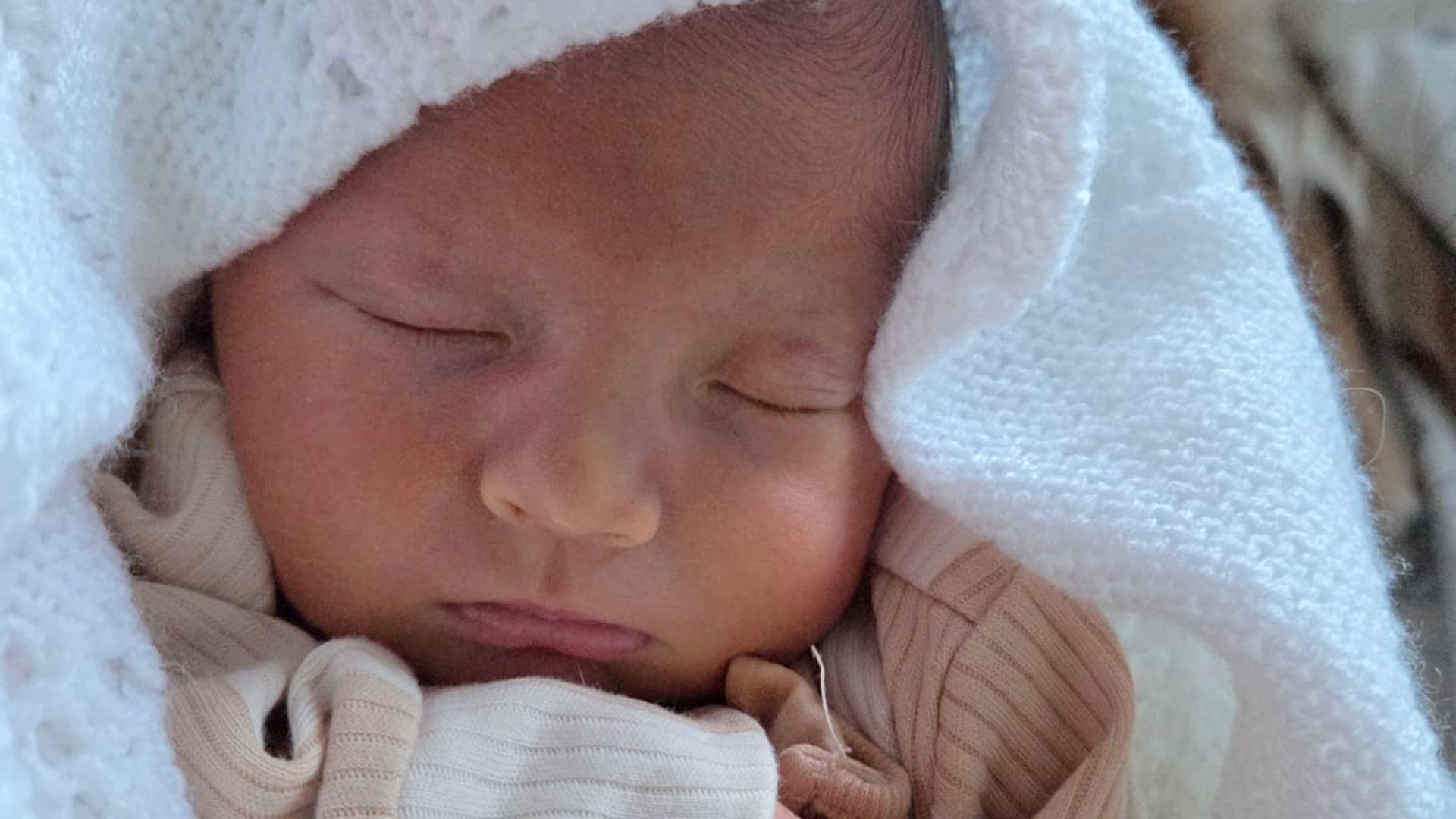 How newborns with jaundice can receive vital treatment at home