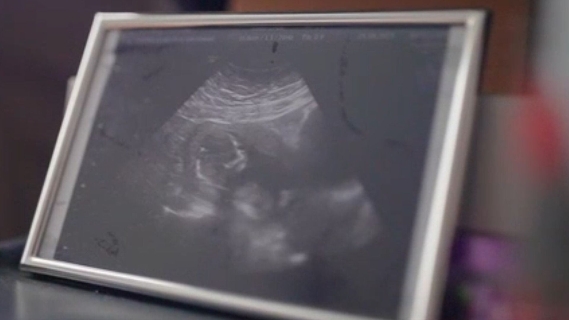Woman says she ‘begged for pain relief but was told no’ – amid national call for birth stories