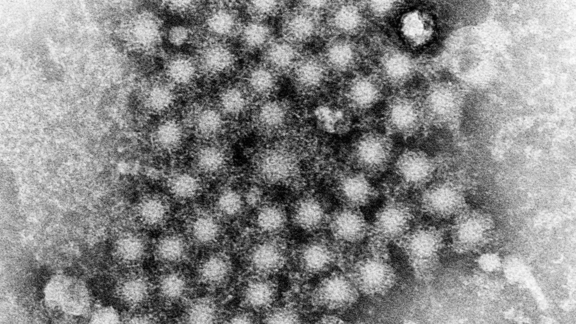 Parents told to check children’s handwashing after hepatitis A outbreak
