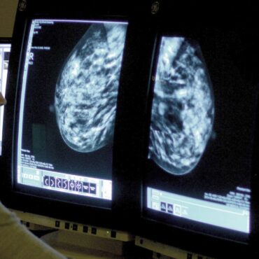 ‘Concerning’ rise in cancer cases among adults under 50
