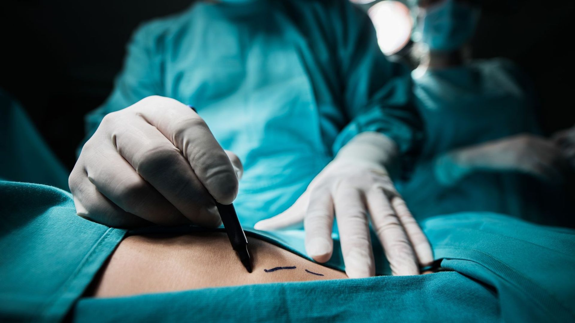 ‘Cosmetic cowboys’ to face fines if they carry out risky procedures